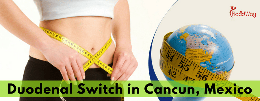 Duodenal Switch Surgery  in Cancun Mexico